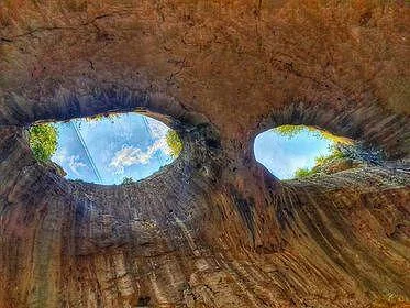 ГЛАУКОМА - ЛЕЧИМА ЛИ Е "ЗЕЛЕНАТА ЗВЕЗДА"?!